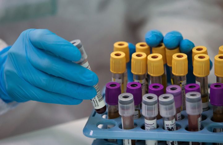 Azərbaycanda koronavirus ilə bağlı son vəziyyət